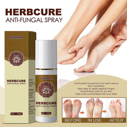 Anti-Odor Voetspray - Natuurlijk, Verfrissend & Effectief tegen Geur