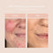 Cent Pur Cent Loose Anti-Redness Powder - Eenvoudig in gebruik - Bye Bye roodheid