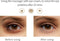 Smart Eye Massage - Elektrische Oogmassager - Luchtdrukcompressie en Verwarming