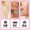 Leafline® IPL Laser Ontharingsapparaat - Epileerapparaat Dames - Pijnloos met Ice Cooling - 999.999 flitsen