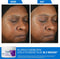 CeraVe Skin Renewing Peptide Crème - Gevoelige huid - Peptide Complex en Ceramiden - 48g