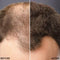 Toppik Colored Hair Thickener Zwart- Haarverdikker Spray - Verbergt haaruitval - Direct voller haar