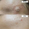 Nine Less A-Control - Serum - 10% Azelaic Acid - 2ml sample