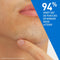 CeraVe Anti-Puistjes Patches - Voor acne-gevoelige huid - Met 3 Essentiële Ceramiden & Niacinamide - (22 patches)