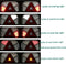 LED Achterlichtenset voor Aanhanger 12/24V - 23,7 x 13,8 cm - 7 Functies - 2 Stuks