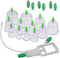 Chinese Cupping - 20 Delig - Massage - Cupping Set - Cupping Set Massage - Cups