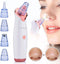 DAKANNA® - Mee eters Verwijderen - Blackhead Remover - Mee eter Verwijderaar - Gezichtsverzorging - Elektrisch - Acne - Vacuum - Huidverzorging - Multitool Set