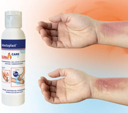 Detectaplast - Brandwondengel - Burn Gel - 118ML