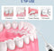 Draadloze Watertandenreiniger - Met 5 standen en Doe-Het-Zelftips - Professionele Draagbare Tandheelkundige Irrigator