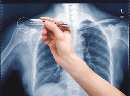 Edding 8010 Röntgenmarker Wit