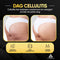 LivingBoost® - Elektrische Cupping Massage - 12 Standen en Warmtefunctie - Inclusief Gua Sha (2 stuks)