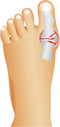 Grote Teen Correctors - Teenbrace voor 's nachts -Teen bescherming - Teenspreider - 1 paar