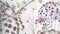 Heckettlane Dekbedovertrek Della - Bedlinnen met Bloemen print - 240x220 - Wit - Dekbedhoes van 100% Katoen-Dobby
