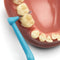 TePe Angle Interdentale Ragers Mixed Pack ISO maat 1 - 6 – (0,4 mm – 0,8 mm)
