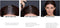 L'Oréal Paris (public) Hair Touch Up