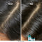 L’Oréal Professionnel Scalp Advanced Shampoo Anti-Oiliness - Talgregulering & reinigend - Voor een vette hoofdhuid - 300 ml