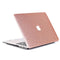 Lunso Geschikt voor MacBook Pro 13 inch (2016-2019) cover hoes - case - glitter roze