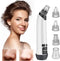 Luxevo Poriënreiniger - 4 Opzetstukken - USB C Oplaadbaar - Verwarmd - Mee Eters Verwijderen - Blackhead Remover - Mee Eter Verwijderaar - Wit