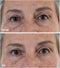 My perfect Eyes Weg met rimpels, wallen en donkere kringen Oogcrème