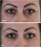 My perfect Eyes Weg met rimpels, wallen en donkere kringen Oogcrème