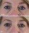 My perfect Eyes Weg met rimpels, wallen en donkere kringen Oogcrème