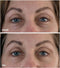 My perfect Eyes Weg met rimpels, wallen en donkere kringen Oogcrème
