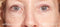 My perfect Eyes Weg met rimpels, wallen en donkere kringen Oogcrème