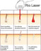 Rio YES™ LAHC6 - Laserontharingsapparaat - Permanente haarvermindering - Wit