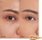 Shiseido Synchro Skin Self-Refreshing Concealer 1 st | MEDIUM - 301 | - 301 Medium