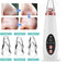 Premium Blackhead Remover I Poriënreiniger met 6 Opzetstukken Mee eters verwijderen | Acne | Comedonenlepels | Huidverzorging