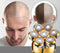 Professioneel Scheerapparaat 5-in-1 - 7D - 9 opzetstukken - Draadloos - Nat & droog - Tondeuse & trimmer