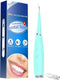 Tandsteen Remover - 12.000 trillingen per minuut - Elektrische Draagbare Orale Irrigatie Tanden Whitening - Tandsteen Schraper - Usb oplaadbare tandsteenverwijderaar