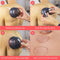 Nuvance Cupping Cups - Cupping Set Massage - 4 Siliconen Cups - Inclusief eBook (4 stuks)