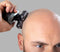 Remington RX7 Ultimate Headshaver Skullshaver - Scheerapparaat voor het hoofd - XR1600