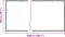 vidaXL - Plantenafdekking - met - zeilringen - 2x10 - m - polyethyleen