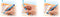 STAEDTLER Lumocolor correctable pen M - box 4 kleuren