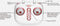 Syma X5UC 720p HD Camera Drone