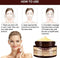 Anti-Acne crème
