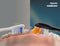 Philips Sonicare S2 - Opzetborstels voor Elektrische Tandenborstel - Gevoelige tanden - Wit