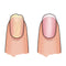 Herome Essential Dry And Ridging Nails Yellow Set