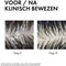 Vichy Dercos Technique 2in1 Anti-roos Shampoo + Conditioner - Alle haartypes - Roos en Jeuk - 200ml