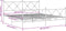 vidaXL - Bedframe - met - hoofd- - en - voeteneinde - metaal - zwart - 183x213 - cm