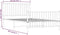 vidaXL - Bedframe - met - hoofd- - en - voeteneinde - metaal - zwart - 107x203 - cm