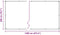 vidaXL - Doorzichtig - zeildoek - met - zeilringen - 2x10 - m - PVC