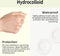 VT Cosmetics - Cica Spot Patch - 48 Stuks - Valentijnsdag
