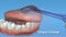 Waterpik TC-100 - Tongreiniginstips - Geschikt voor de WP-100, WP-450 en WP-360 - 2 Stuks