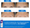 CeraVe Skin Renewing Retinol Serum - Gevoelige huid - Ingekapselde Retinol en Ceramiden - 30ml