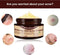 Anti-Acne crème