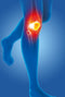Epitact - Knie medical - Stabiliseert en verlicht pijn - Maat L 41-44cm