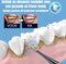 Allernieuwste.nl® SET Oplaadbare Sonische Tandenborstel PLUS Tandsteenverwijderaar - Ultrasone Reiniging 5 standen 31000/min - Kleur Wit